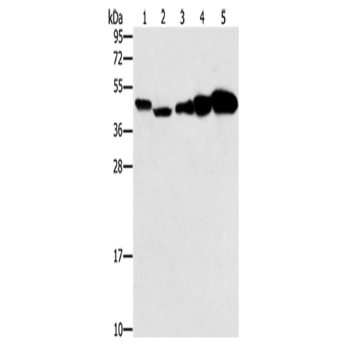 PPAT rabbit polyclonal antibody