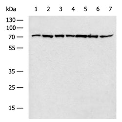 HSPA9 rabbit polyclonal antibody