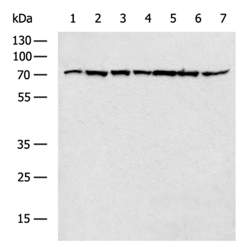 HSPA9 rabbit polyclonal antibody