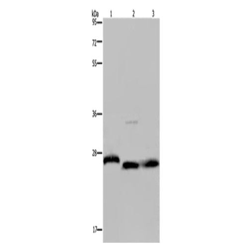 GSTP1 rabbit polyclonal antibody