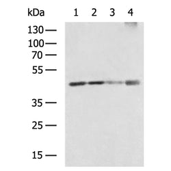 RBMX rabbit polyclonal antibody