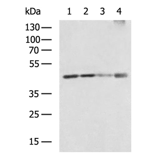 RBMX rabbit polyclonal antibody