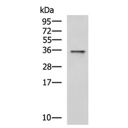 HSD17B13 rabbit polyclonal antibody