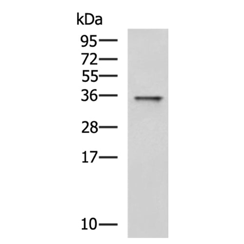HSD17B13 rabbit polyclonal antibody