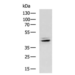 HSD3B1 rabbit polyclonal antibody