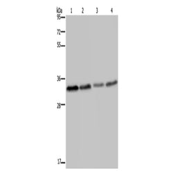 TICAM2 rabbit polyclonal antibody