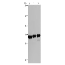 PCK2 rabbit polyclonal antibody