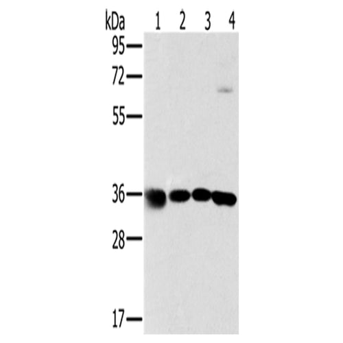 MRPL39 rabbit polyclonal antibody