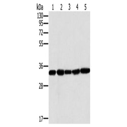 MTCH2 rabbit polyclonal antibody