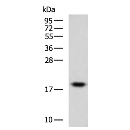 MTFP1 rabbit polyclonal antibody