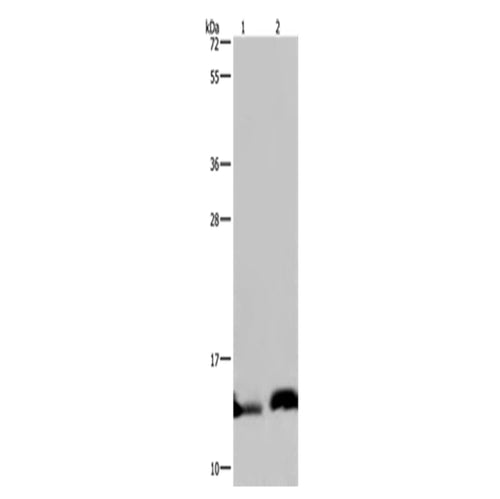 NDUFA5 rabbit polyclonal antibody
