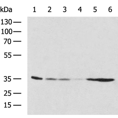 NDUFA9 rabbit polyclonal antibody