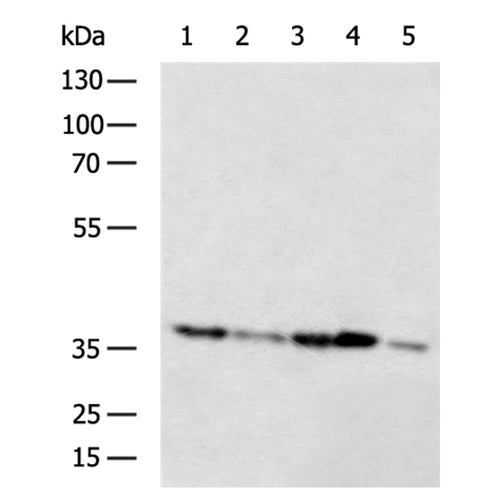 NIT1 rabbit polyclonal antibody