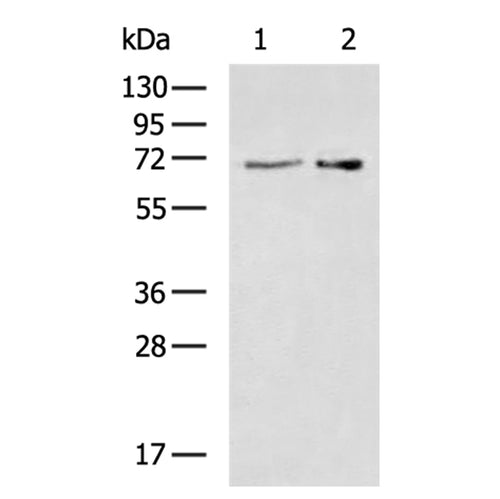 PLS3 rabbit polyclonal antibody