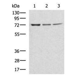 ZBTB16 rabbit polyclonal antibody