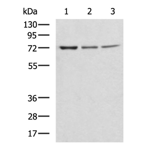 ZBTB16 rabbit polyclonal antibody