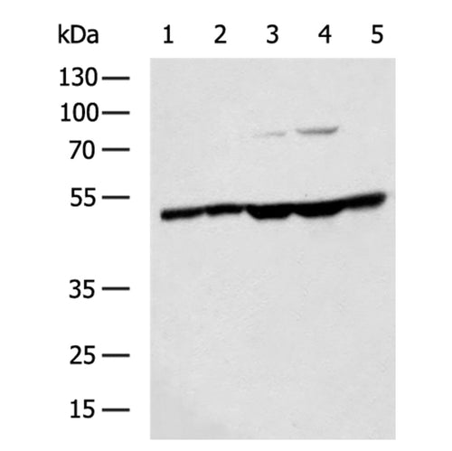 PMPCB rabbit polyclonal antibody