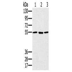 PSMC1 rabbit polyclonal antibody