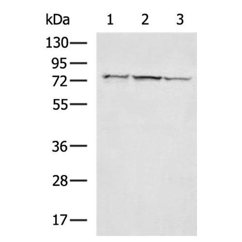 RIPK1 rabbit polyclonal antibody