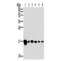 RPLP2 rabbit polyclonal antibody