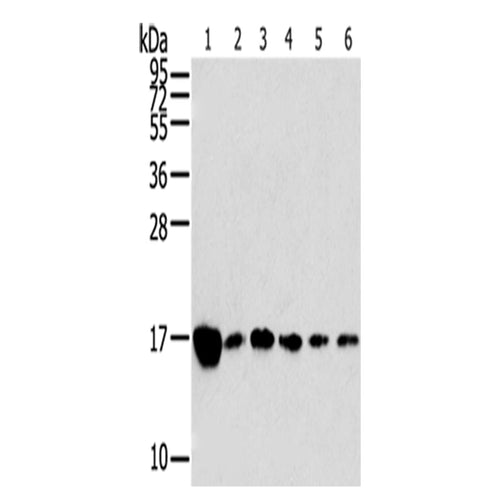 RPLP2 rabbit polyclonal antibody