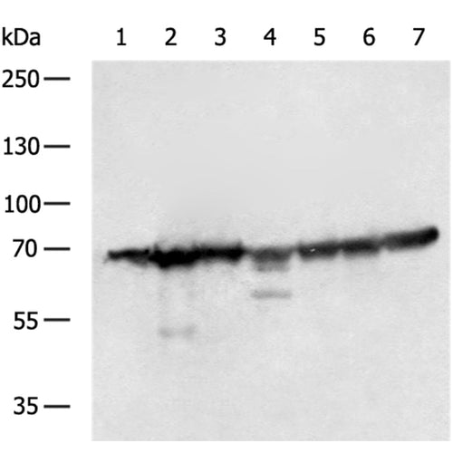 SDHA rabbit polyclonal antibody