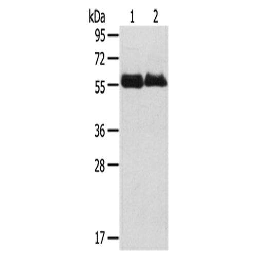 SRPX rabbit polyclonal antibody