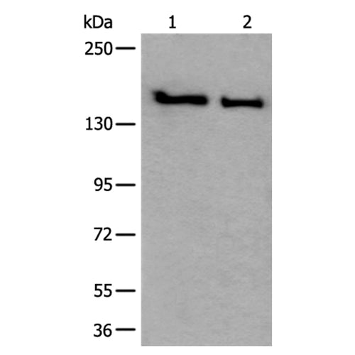 SMC1A rabbit polyclonal antibody