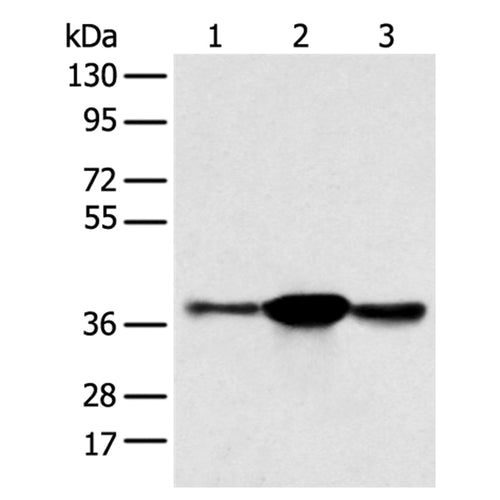 SPRY4 rabbit polyclonal antibody