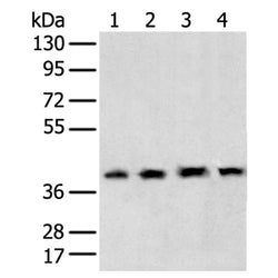 TBP rabbit polyclonal antibody
