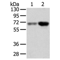 TBL1X rabbit polyclonal antibody