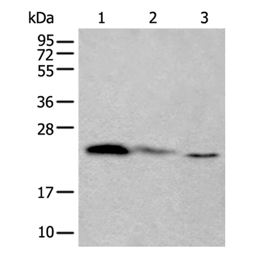 TPT1 rabbit polyclonal antibody