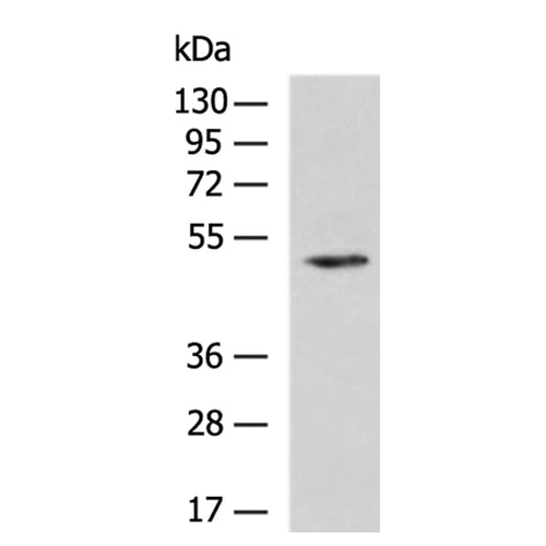 TRIM14 rabbit polyclonal antibody