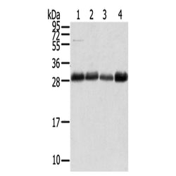 TMED1 rabbit polyclonal antibody