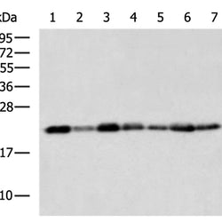 TMED2 rabbit polyclonal antibody