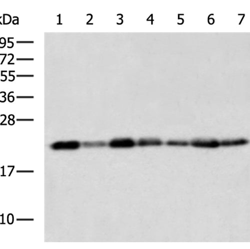 TMED2 rabbit polyclonal antibody
