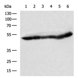 UQCRC1 rabbit polyclonal antibody