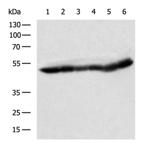 UQCRC1 rabbit polyclonal antibody
