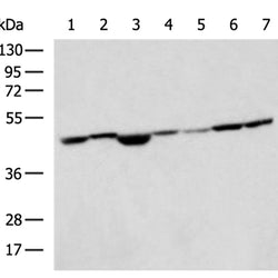 UQCRC2 rabbit polyclonal antibody