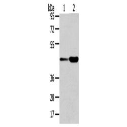 VPS37A rabbit polyclonal antibody
