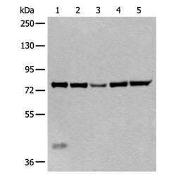 ATF6B rabbit polyclonal antibody