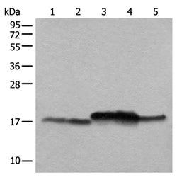 NDUFB11 rabbit polyclonal antibody