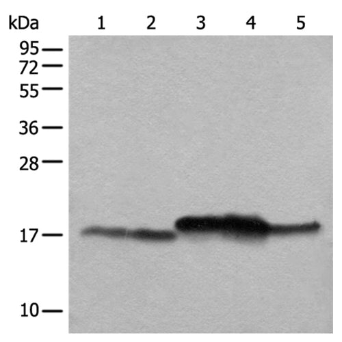 NDUFB11 rabbit polyclonal antibody
