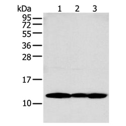 S100A16 rabbit polyclonal antibody
