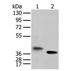LRRC19 rabbit polyclonal antibody