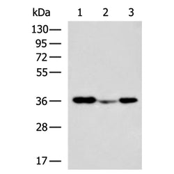 ITLN2 rabbit polyclonal antibody