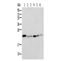 SPCS2 rabbit polyclonal antibody
