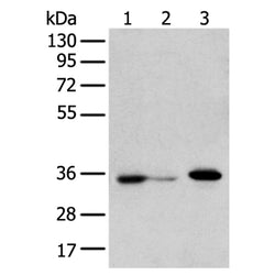 DHRSX rabbit polyclonal antibody