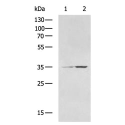 CD1D rabbit polyclonal antibody