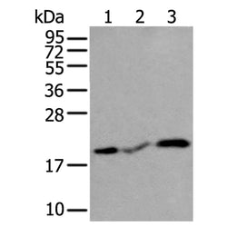 CSRP3 rabbit polyclonal antibody